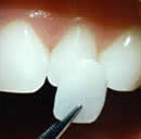 Zahnkorrektur